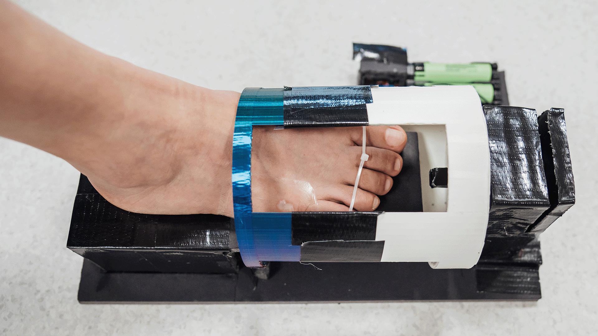 A bandage pre-loaded with magnetic hydrogel is placed on the wound, and an external device is used to accelerate the wound-healing process.