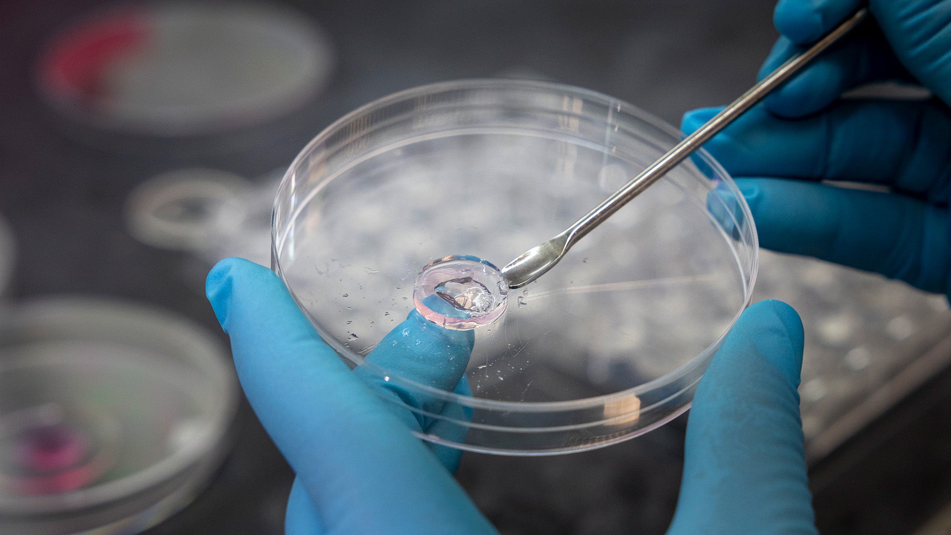 The hydrogel acts as a scaffold that supports the tissue and reduces cell loss.