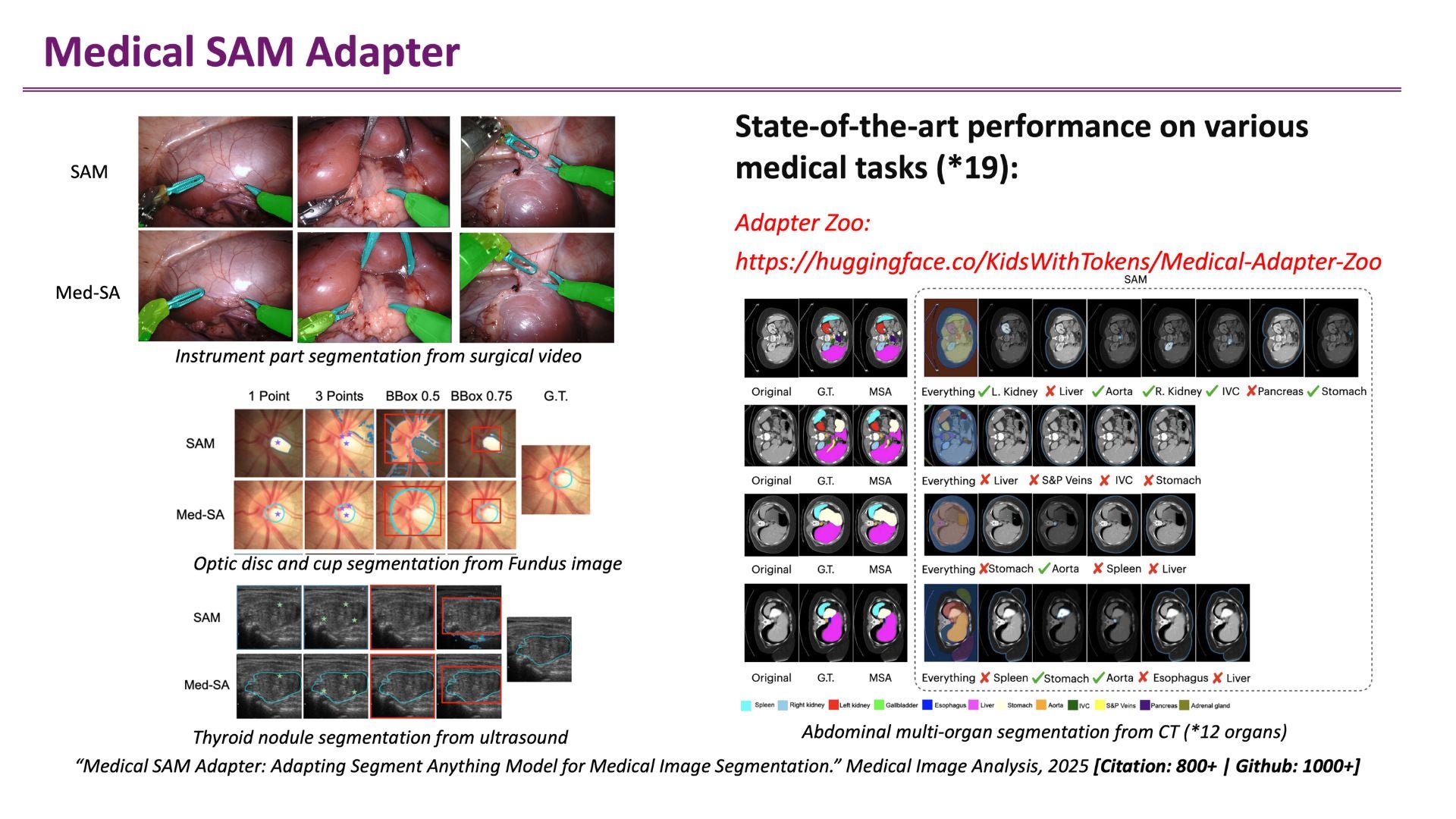 Visual comparison of the Medical SAM Adapter (Med-SA) and the base Segment Anything Model (SAM) across multiple medical imaging tasks, including CT, MRI, and ultrasound segmentation.