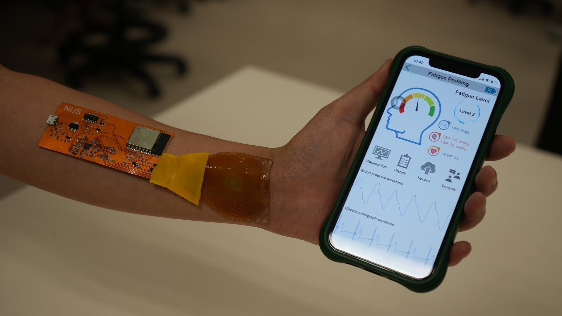 hydrogel sensor system