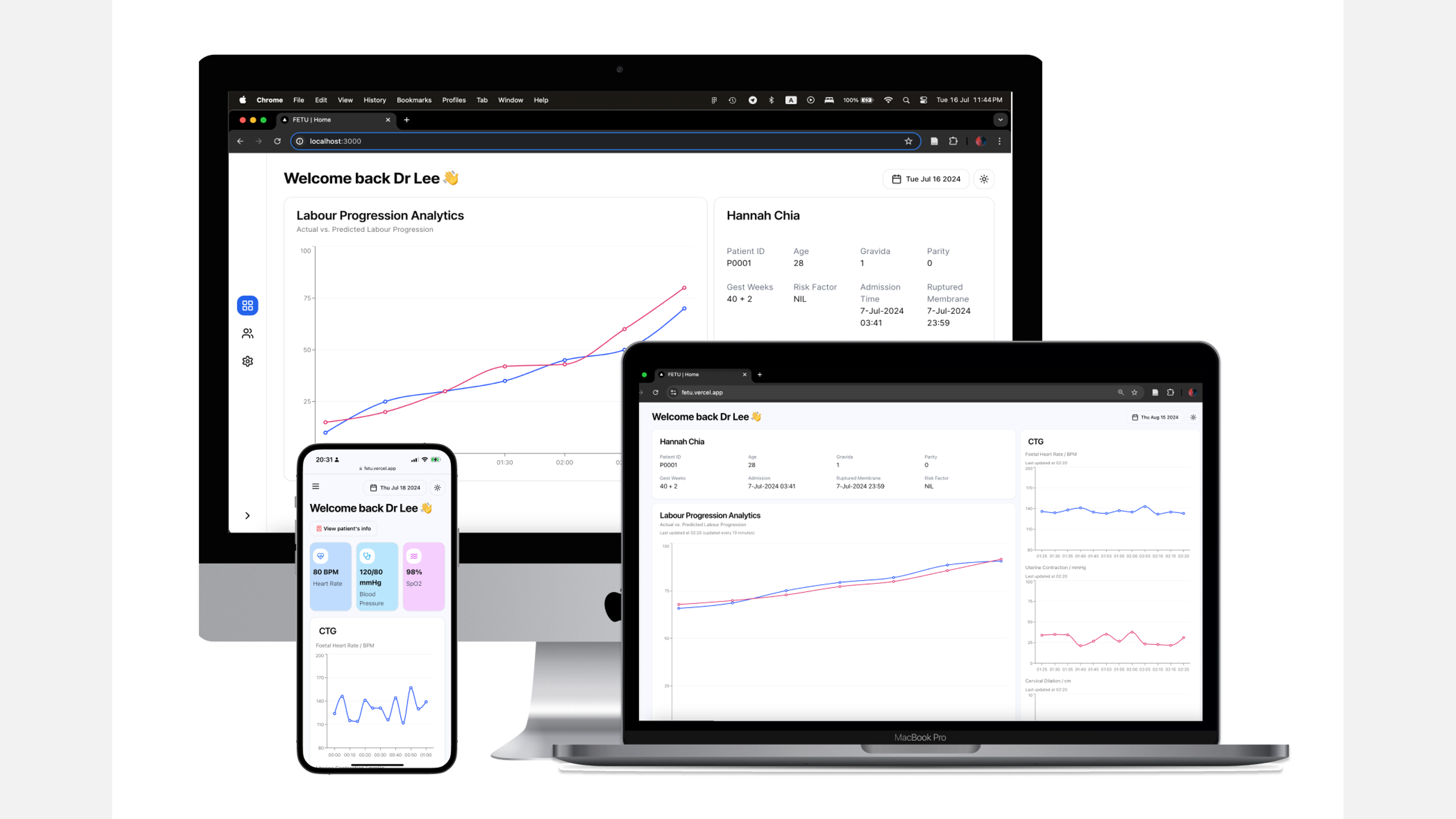 User interface of MaternAI