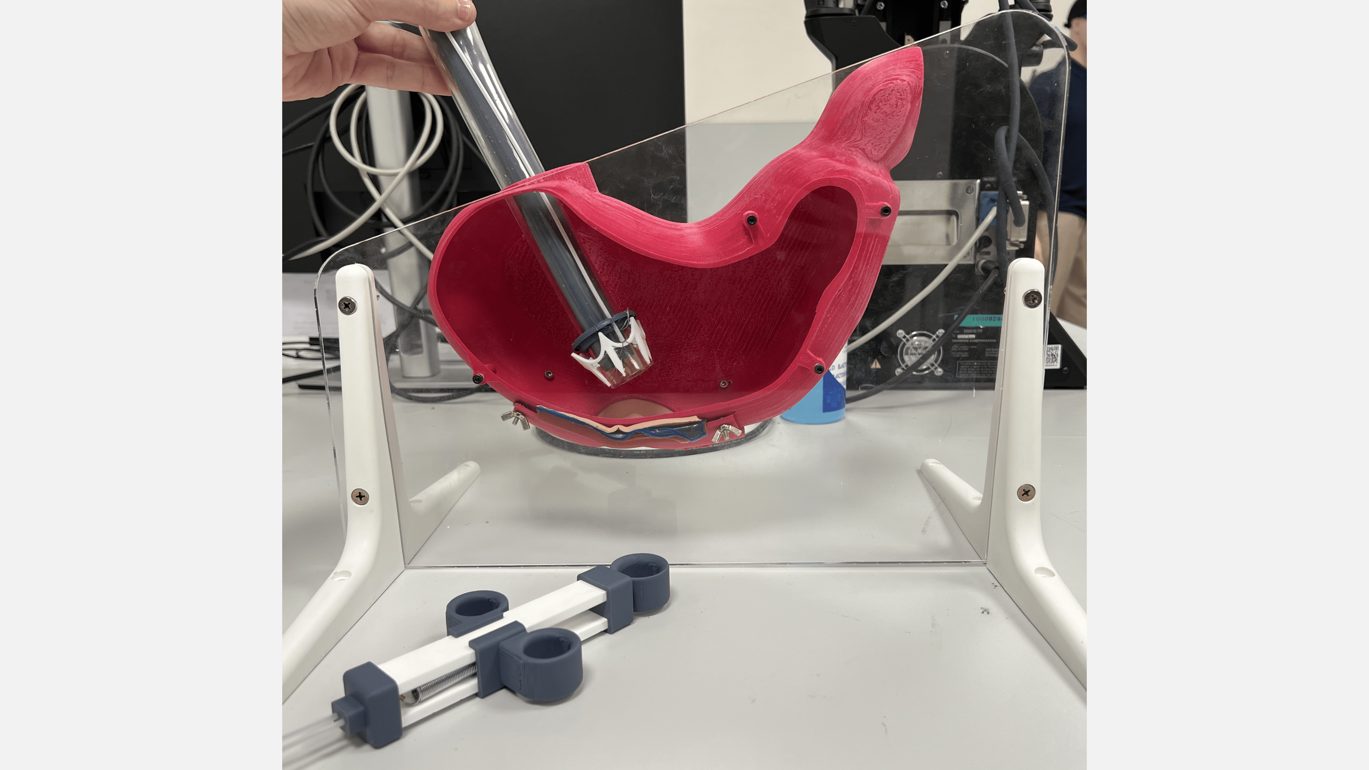 CDE4301-endoscopic-resection-upload
