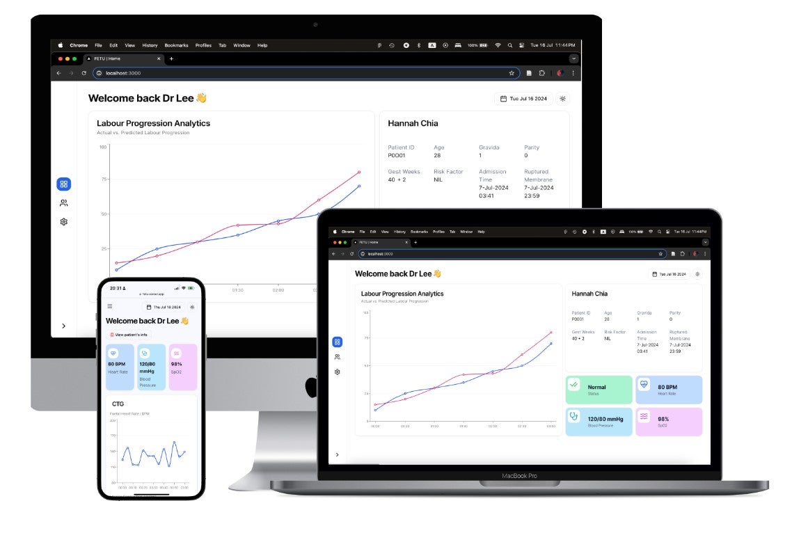 User interface of MaternAI
