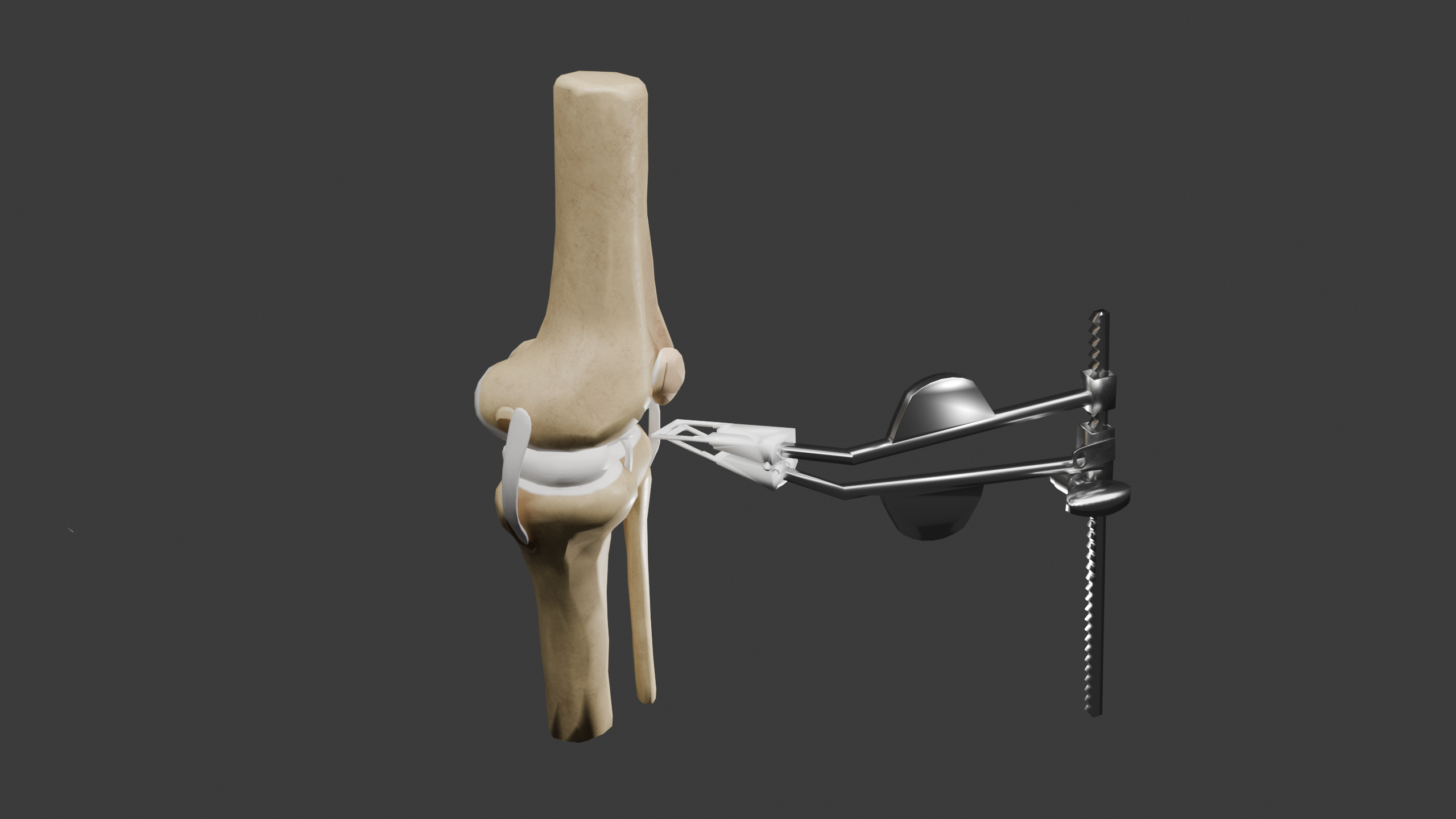 EIM-410-knee-replacement