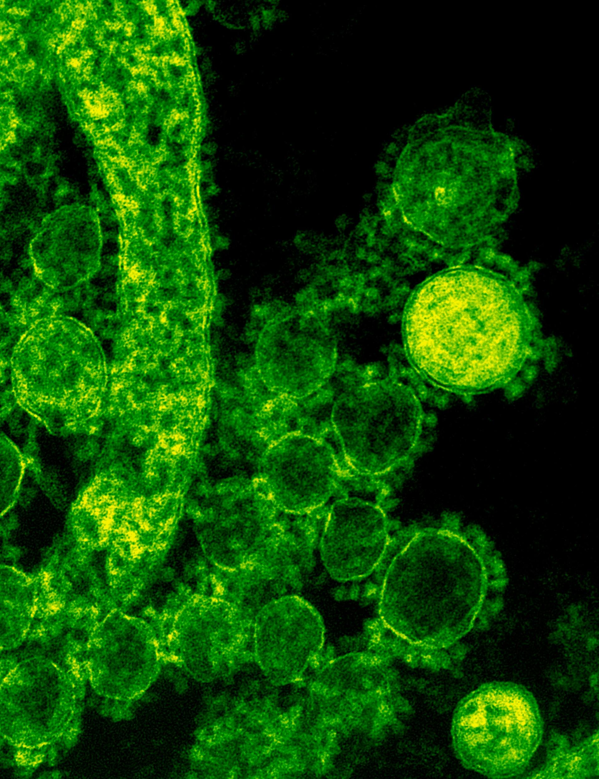 pexels-cdc-library-3992943 Complexity-based models have enabled better responses to the spread of infectious diseases.
Image Credit: CDC / Pexels